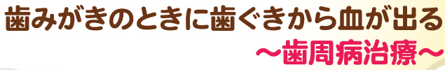 歯みがきのときに歯ぐきから血が出る～歯周病治療～