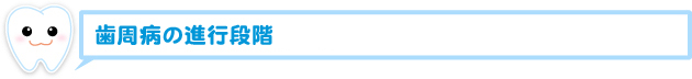 歯周病の進行段階