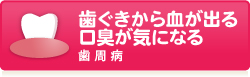 歯ぐきから血が出る口臭が気になる